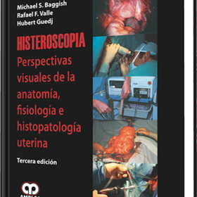 Histeroscopia