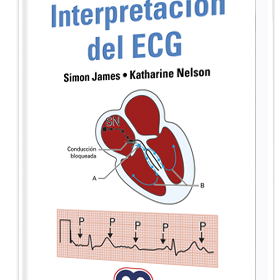 Manual de bolsillo Interpretación del ECG