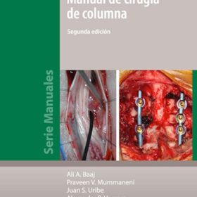 Manual de Cirugía de Columna
