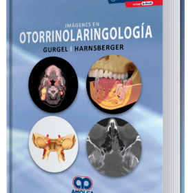 Imágenes en otorrinolaringología