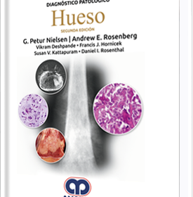 Diagnóstico Patológico Hueso
