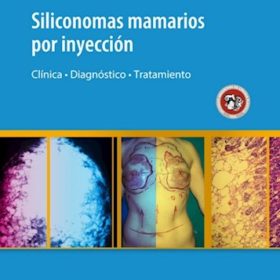 Siliconomas mamarios por inyección Clínica / Diagnóstico / Tratamiento