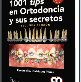 1001 Tips en Ortodoncia y sus Secretos