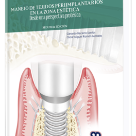 Manejo de Tejidos Periimplantarios en la Zona Estética 2da Ed.