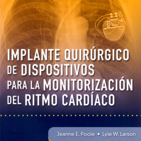 Implante quirúrgico de dispositivos para la monitorización del ritmo cardíaco