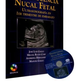 Gallo – Translucencia Nucal Fetal