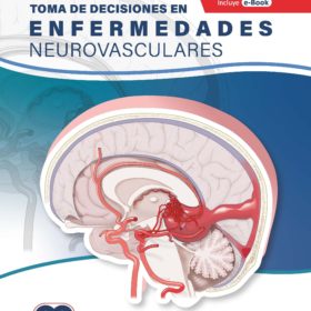 Toma de Decisiones en Enfermedades Neurovasculares – Rangel