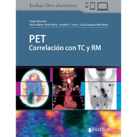 Bennet – PET Correlación Con TC Y RM