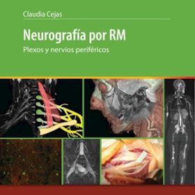 Cejas – Neurografía por RM – Plexos y nervios periféricos