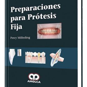 Milleding – Preparaciones para Prótesis Fija