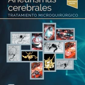 Gonzalez – Aneurismas Cerebrales Tratamiento Microquirúrgico