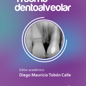 Trauma Dentoalveolar – tobon