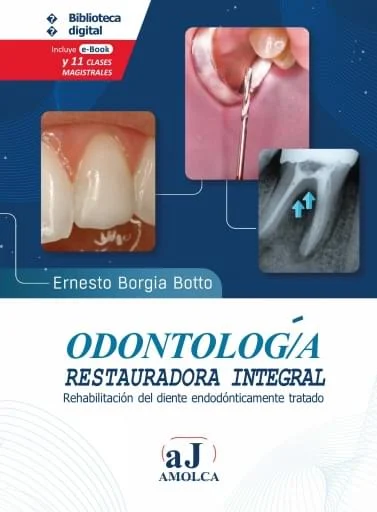 Borgia – Rehabilitacion del Diente Endodonticamente