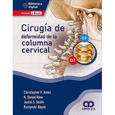 Ames – Cirugia de la Deformidad de la Columna Cervical