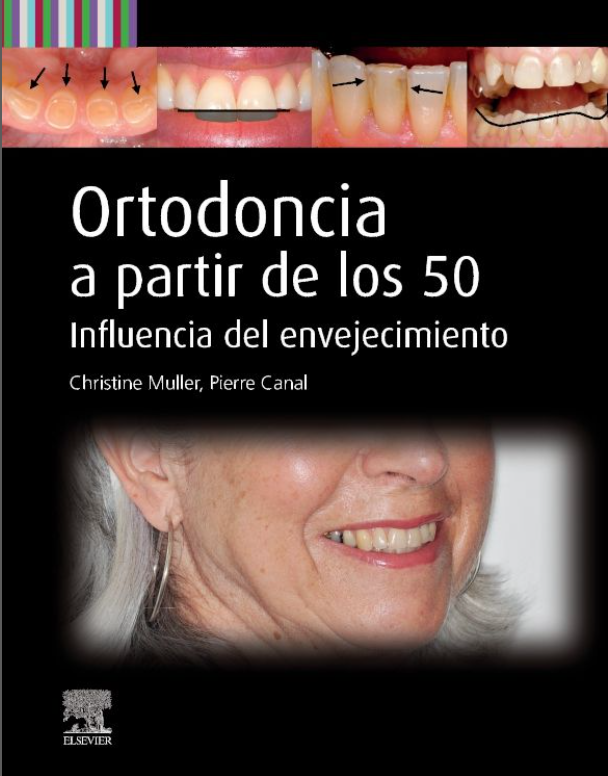 Ortodoncia a partir de los 50 – Muller