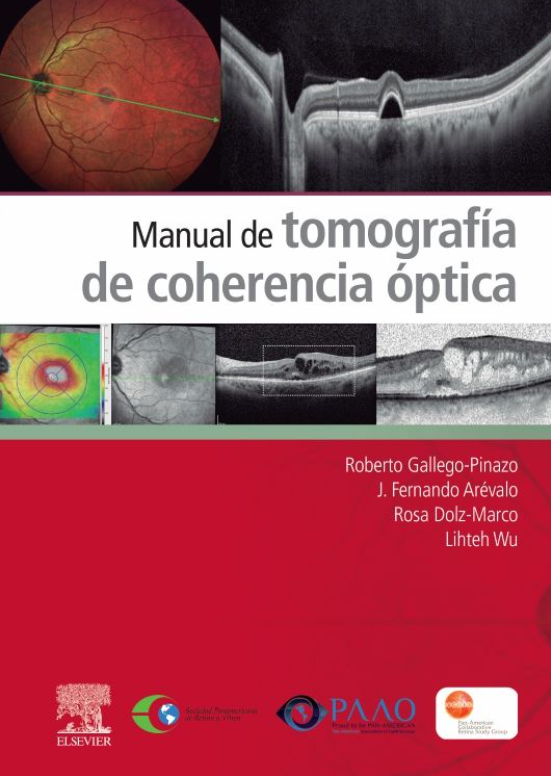 Manual de tomografía de coherencia óptica – Gallego Pinazo