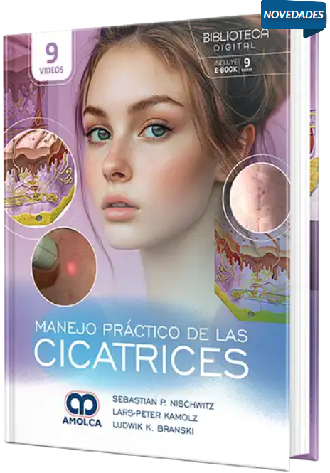 Manejo práctico de las cicatrices – Nischwitz