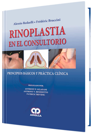 Rinoplastia en el Consultorio – Redaelli