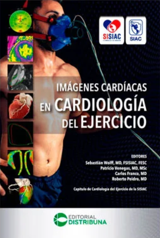 Imágenes cardiacas en cardiología del ejercicio – Wolff