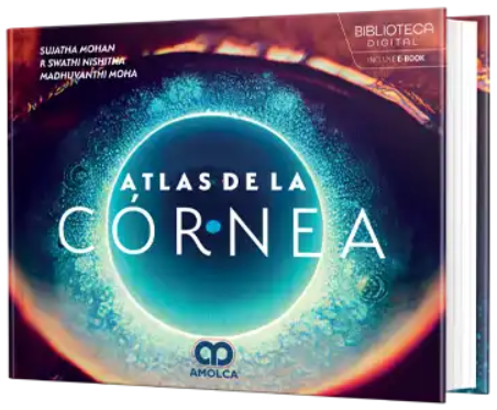 Atlas de la córnea – Mohan