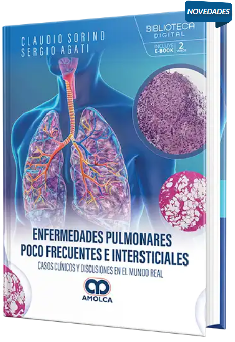 Enfermedades pulmonares poco frecuentes e intersticiales – Sorino