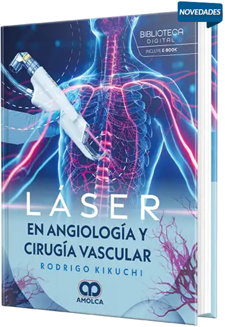 Láser en angiología y cirugía vascular – Kikuchi