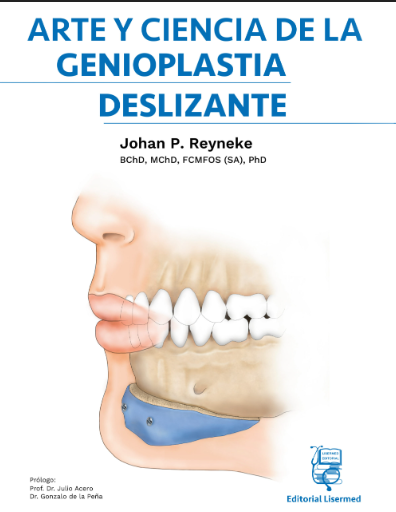 Arte y Ciencia de la Genioplastia Deslizante – Reyneke