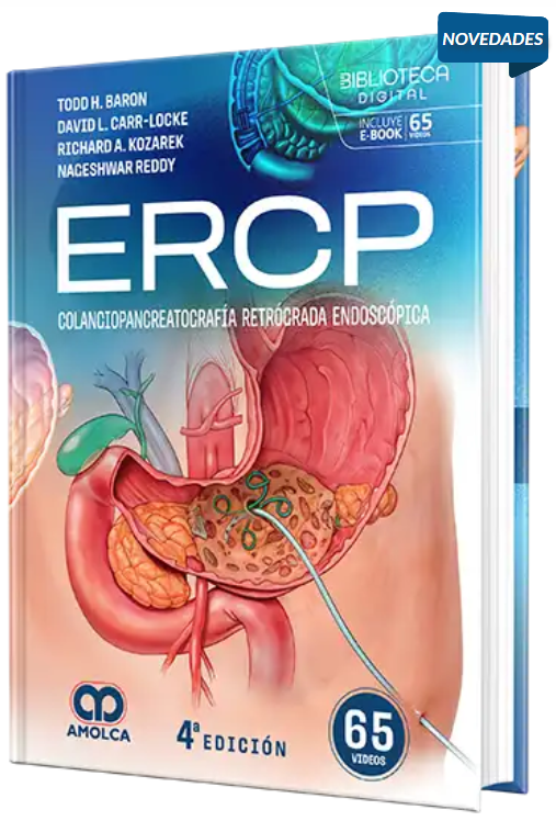ERCP. Colangiopancreatografía retrógrada endoscópica – Baron