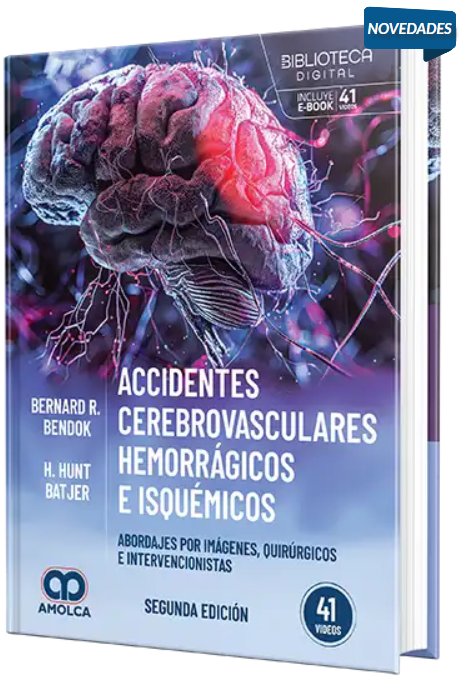 Accidentes cerebrovasculares hemorrágicos e isquémicos. Abordajes por imágenes, quirúrgicos e intervencionistas – Bendok