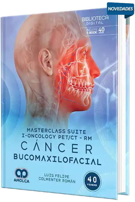 Masterclass suite i-Oncology PET/CT-RM. Cáncer bucomaxilofacial – Colmenter