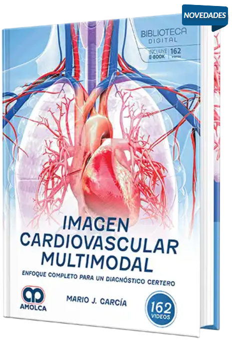 Imagen cardiovascular multimodal. Enfoque completo para un diagnóstico certero – Garcia