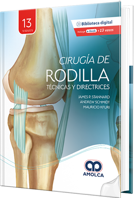 Cirugía de rodilla. Técnicas y directrices – Stannard