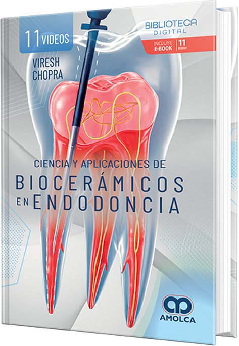 Ciencia y aplicaciones en biocerámicos en endodoncia – Chopra