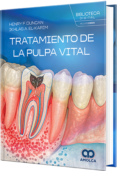 Tratamiento de la pulpa vital – Duncan