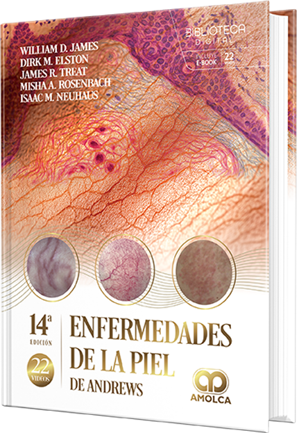 Enfermedades de la piel de Andrews – James