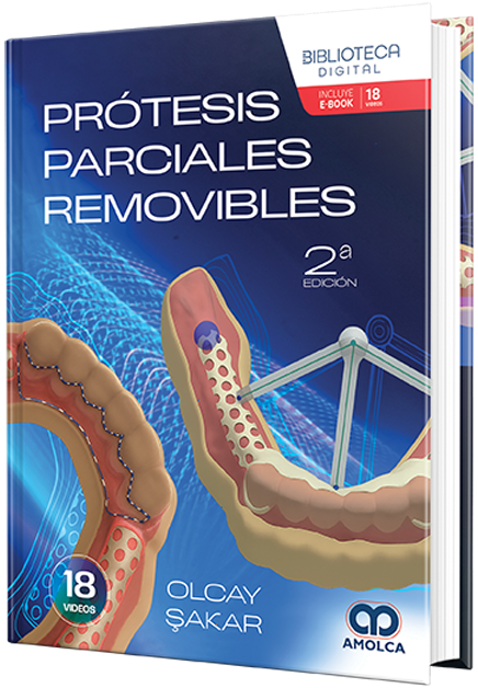 Prótesis parciales removibles – Sakar