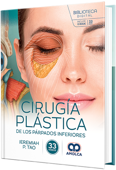 Cirugía plástica de los párpados inferiores – Tao