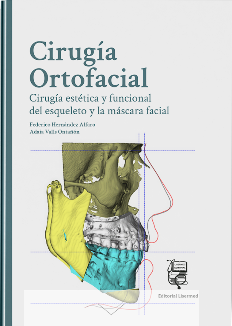 Cirugía Ortofacial. Cirugía estética y funcional del esqueleto y la máscara facial – Hernández