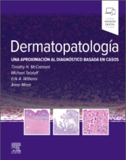 Dermatopatología – Mccalmont