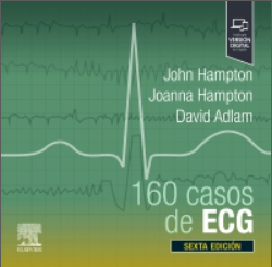 160 casos de ECG – Hampton
